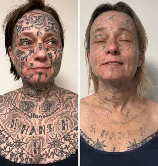 荷兰一女子被男友强迫纹名字 多达250处筹款洗文身！